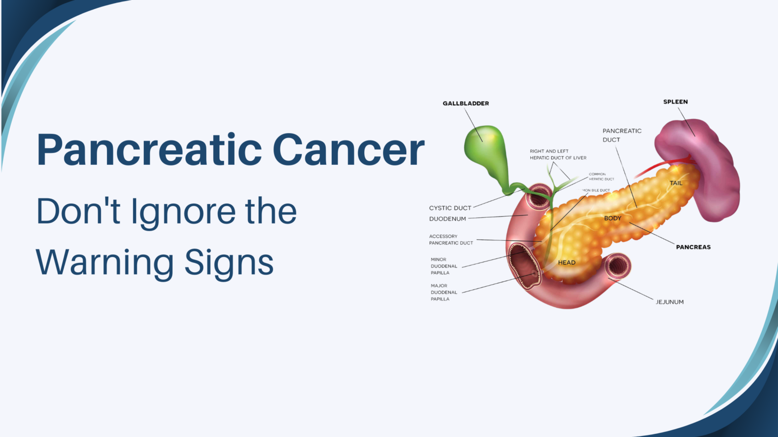 Pancreatic Cancer Dont Ignore The Warning Signs Islamabad