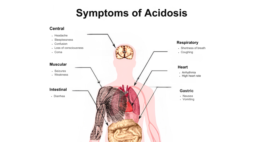 Metabolic acidosis