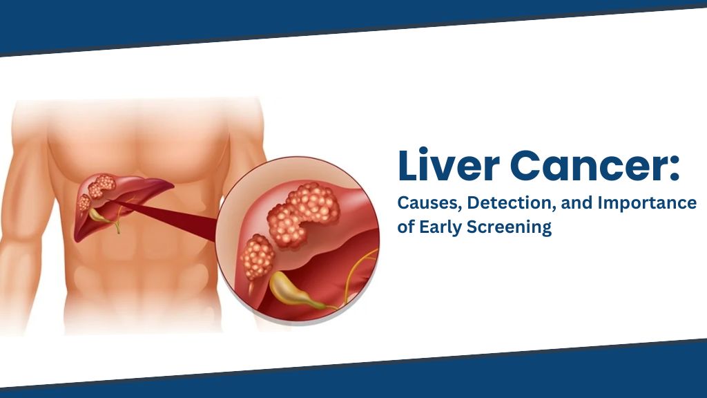 Liver Cancer